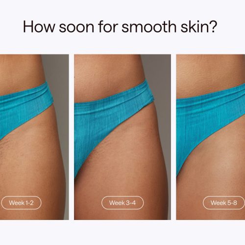 8 Howsoonforsmoothskin 1033fec3 2500 49e6 9120 df9be8a67a90