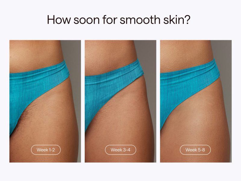 8 Howsoonforsmoothskin 1033fec3 2500 49e6 9120 df9be8a67a90